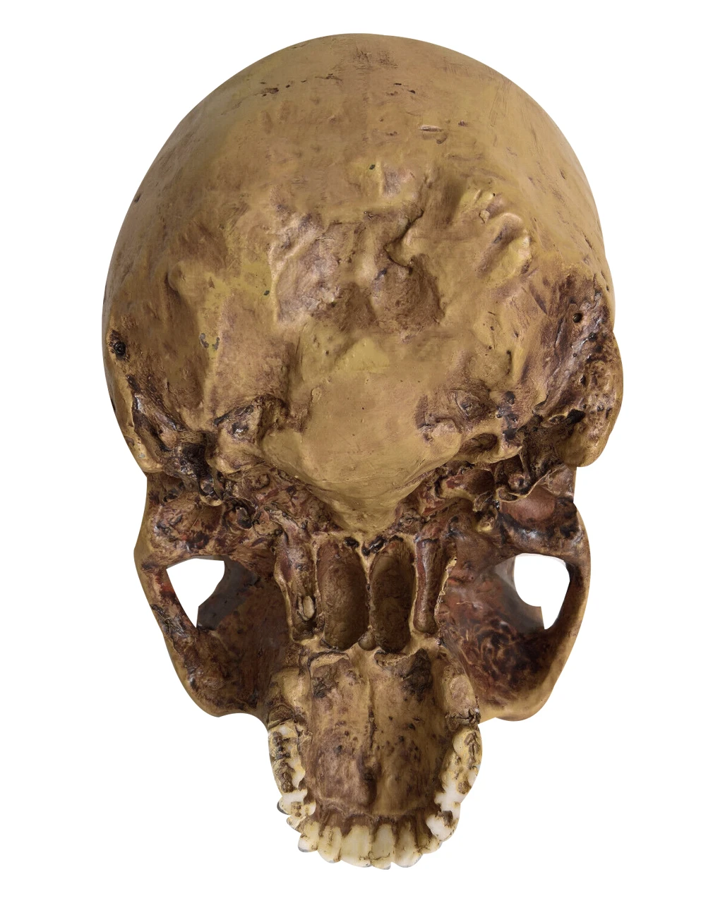 Antiker Totenschädel Ohne Unterkiefer 19cm 6 Antiker Totenschädel Ohne Unterkiefer 19cm – Bild 4
